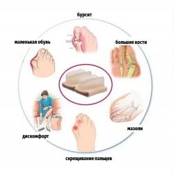 Для тих, у кого росте "гулька" на згині стопи. Відділювач великого пальця ___KRY047/049 (2767)